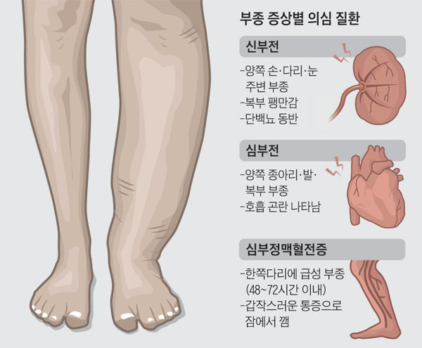 Post image 93