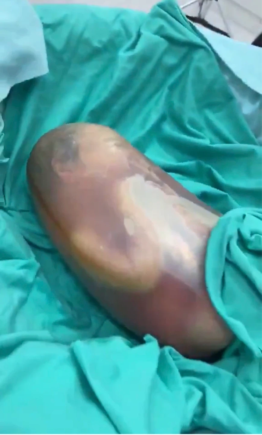 태어났다는 사실을 모른 채 세상에 온 아기