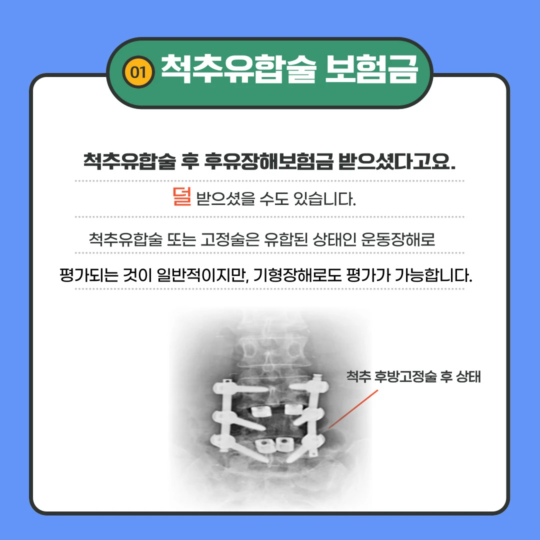 척추 유합술 후유장해 보상 가능