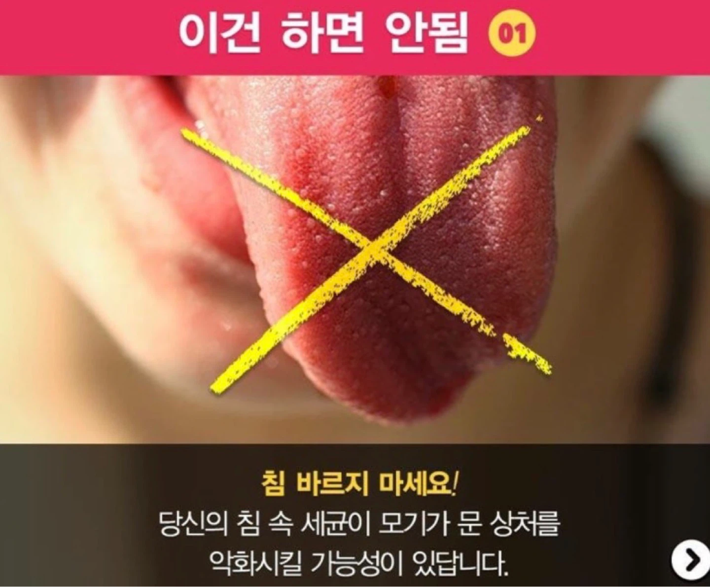 벌써 모기가 ~ㅜㅜ