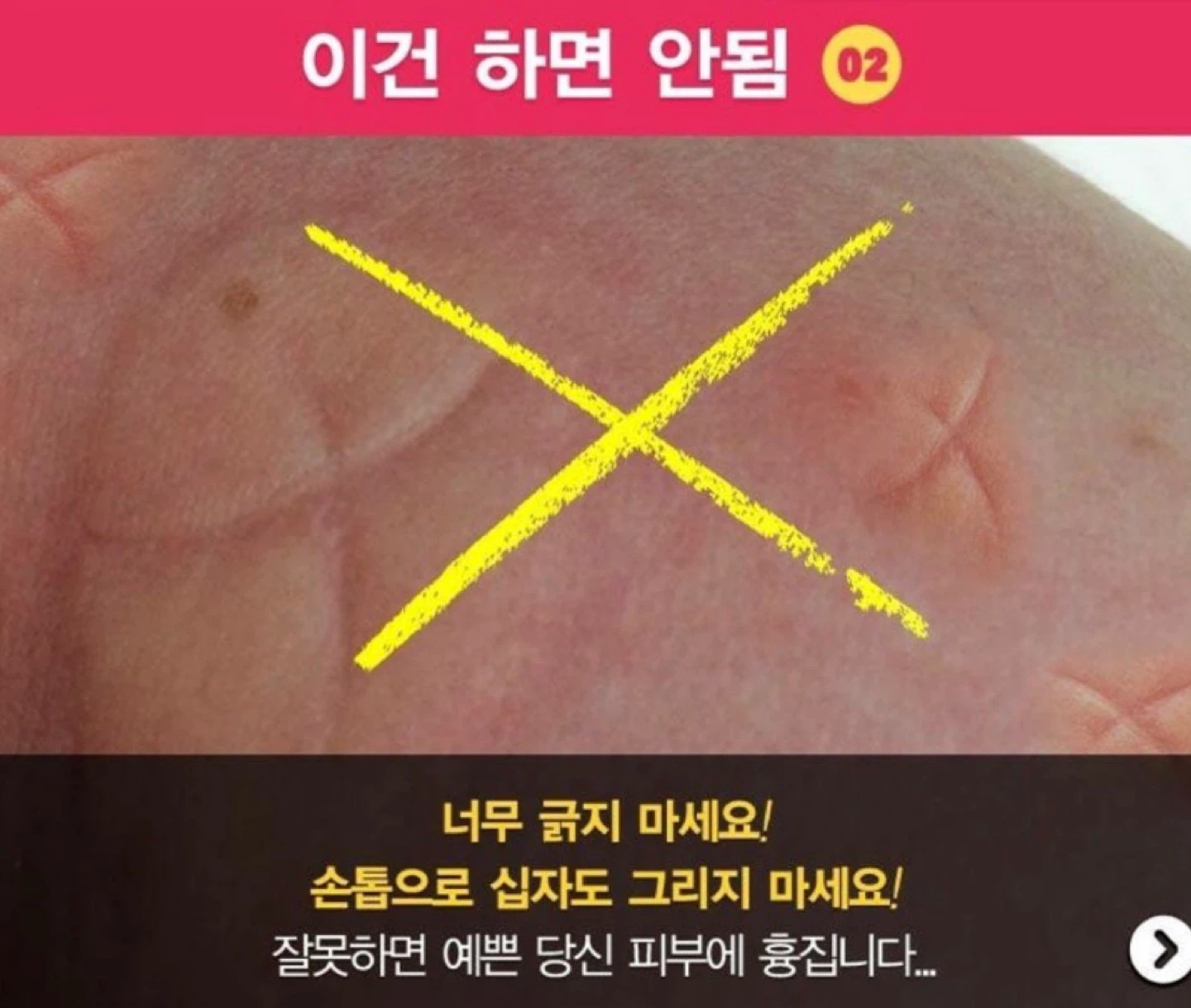벌써 모기가 ~ㅜㅜ