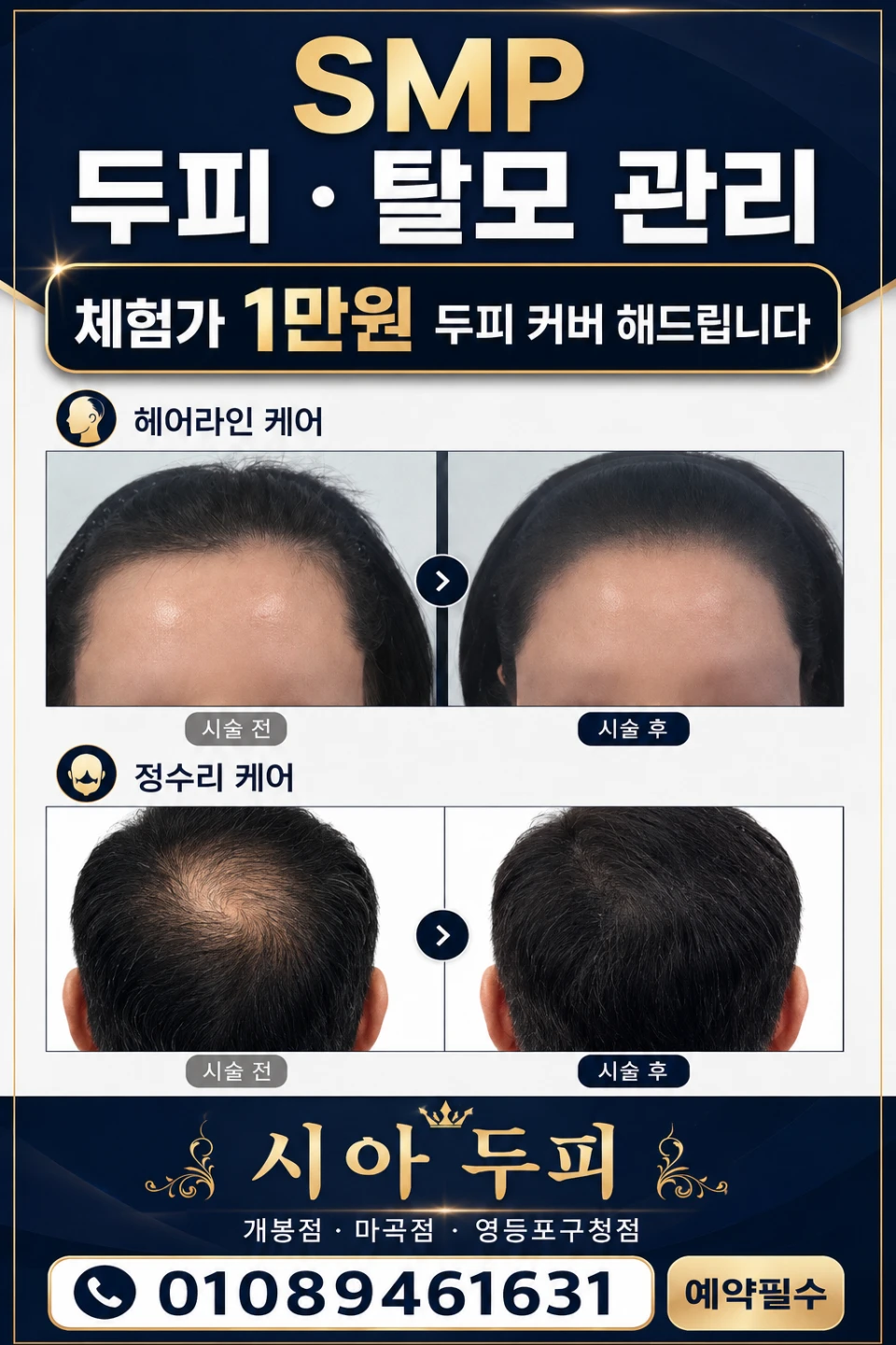 나이에어울리는눈썹과두피관리는어떻게하시나요