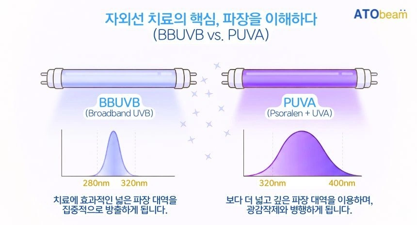 [궁금해요, 아토빔] UVB / PUVA 치료의 차이점 | 경기도 시흥시 능곡동 | 의료기기판매 | 당근 비즈 소식