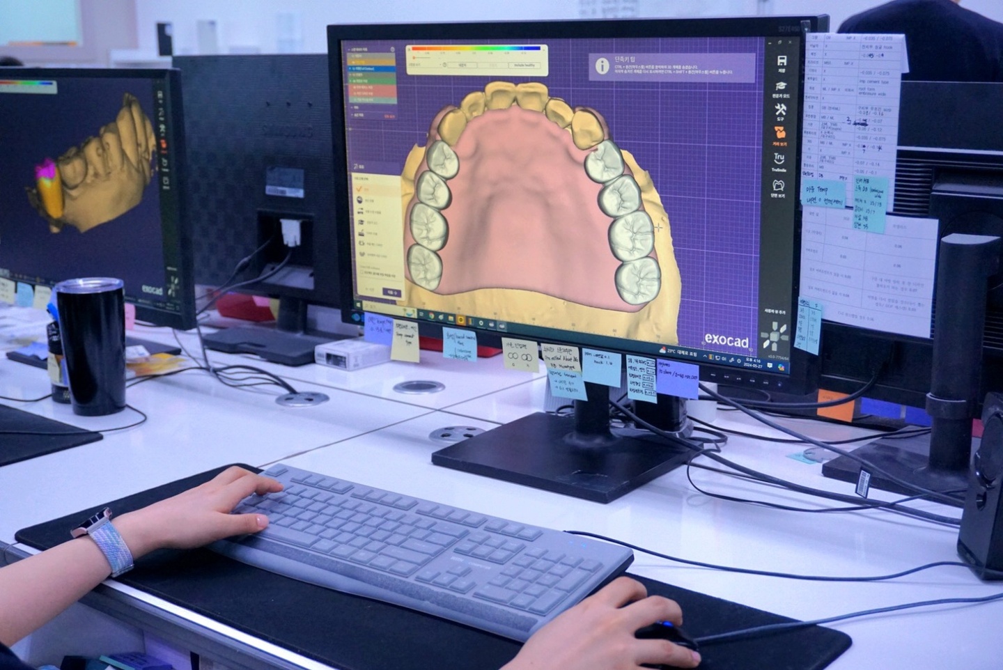 구로동 지르카 디지털 기공소 아르바이트 장소