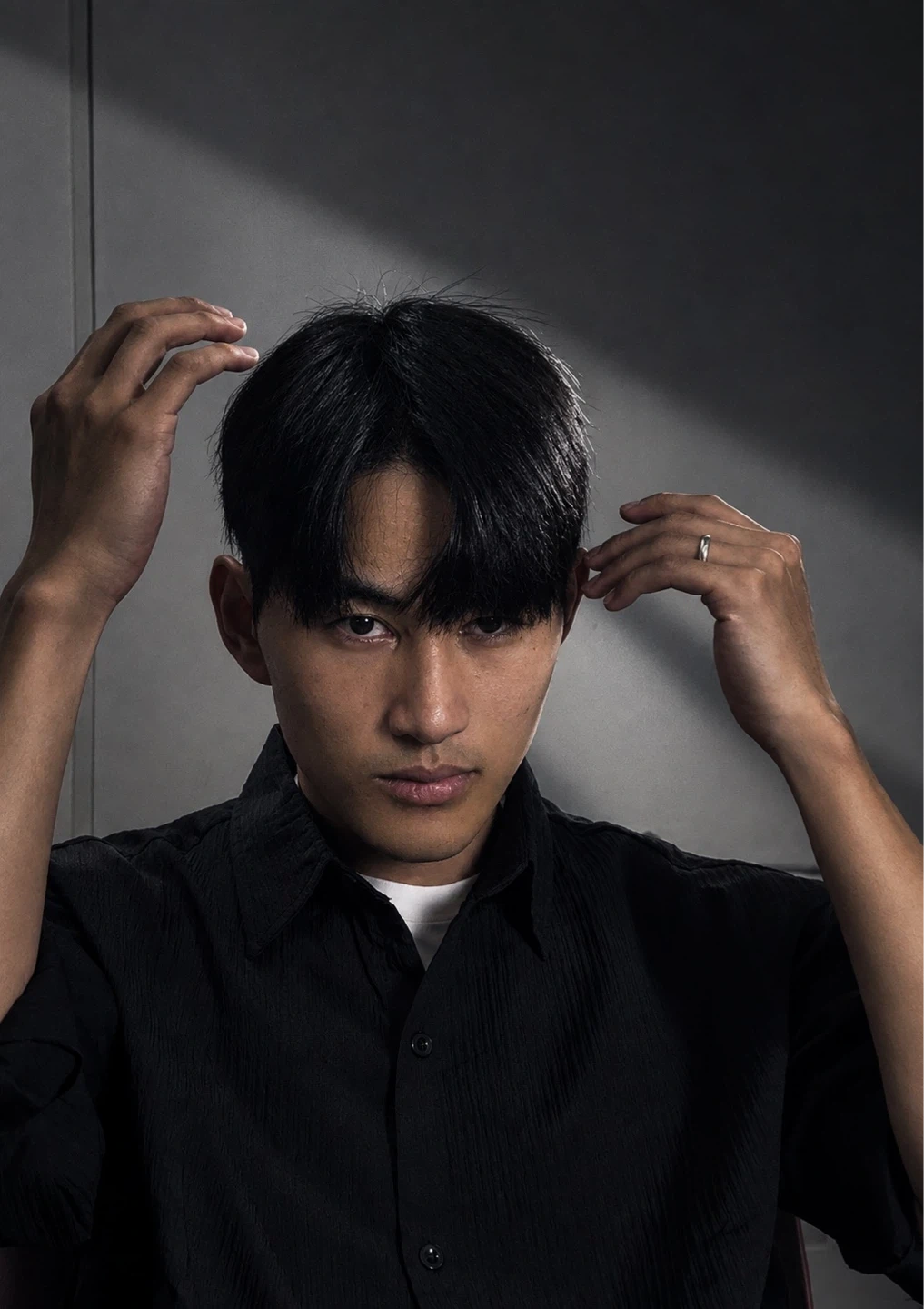 탈모.일반 시술 모델 모집합니다