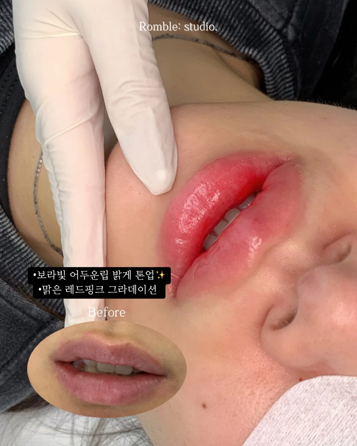 틴트립 모델