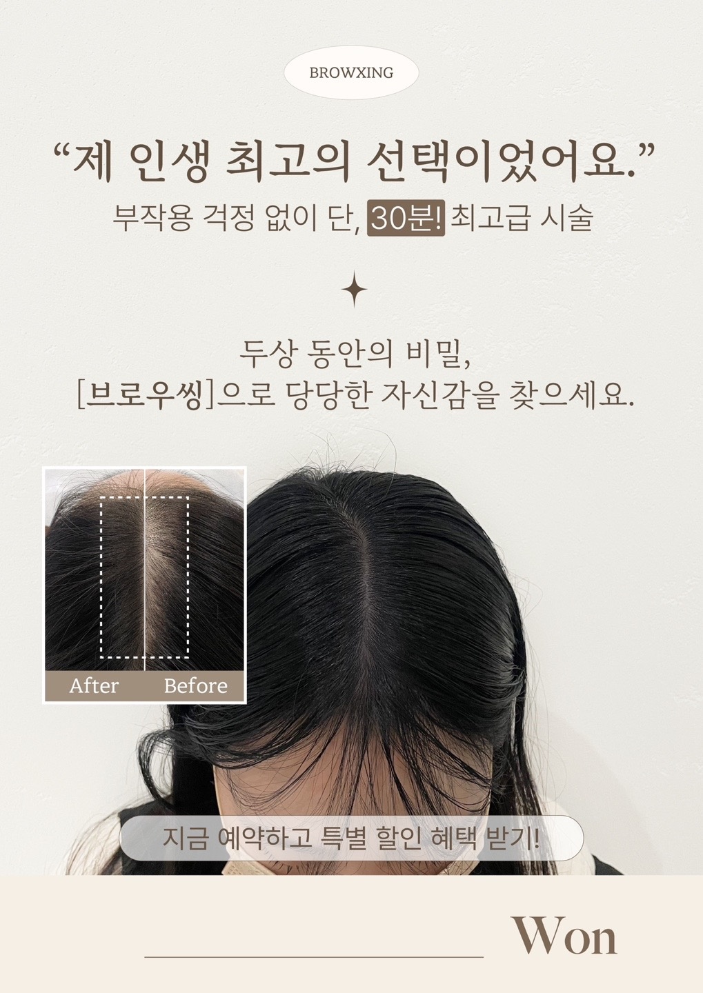 두피채움 경험해보실 분 공고 썸네일