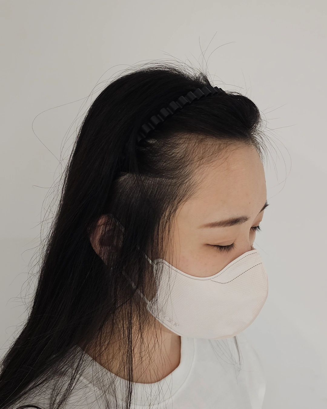 남녀 탈모 모델 구인