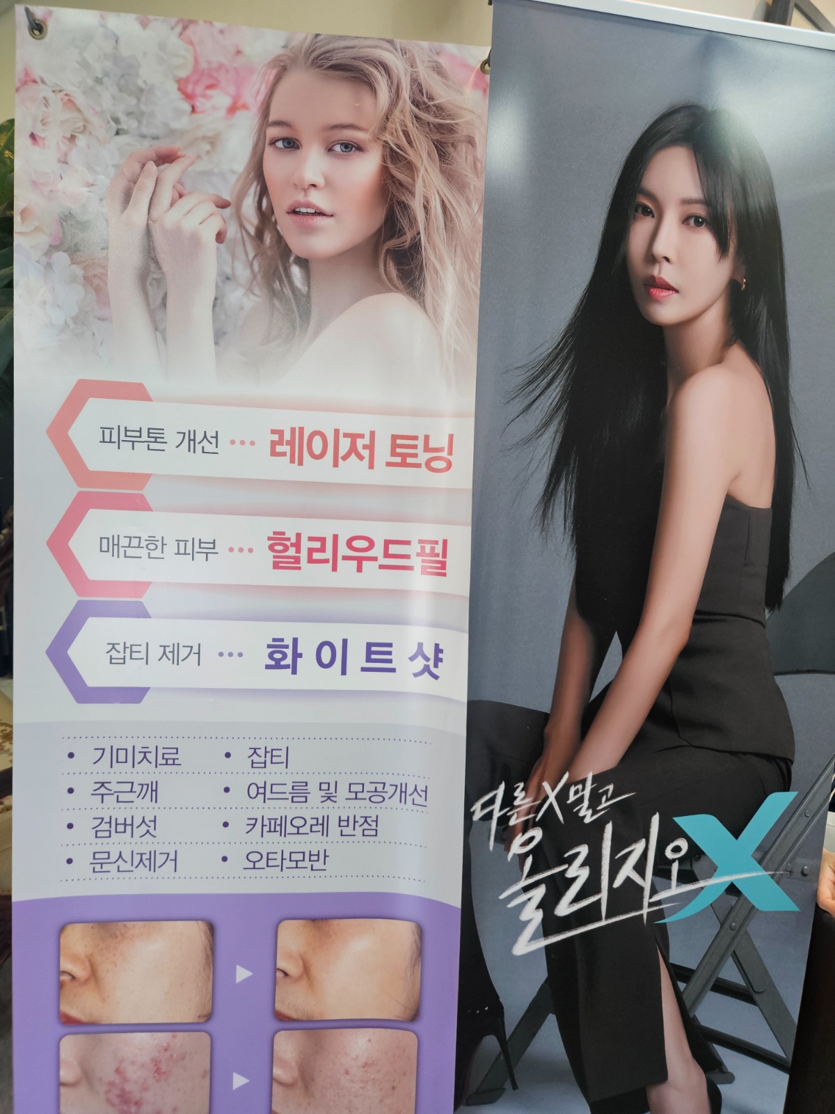평일고정알바 간호조무사 구인합니다. 공고 썸네일