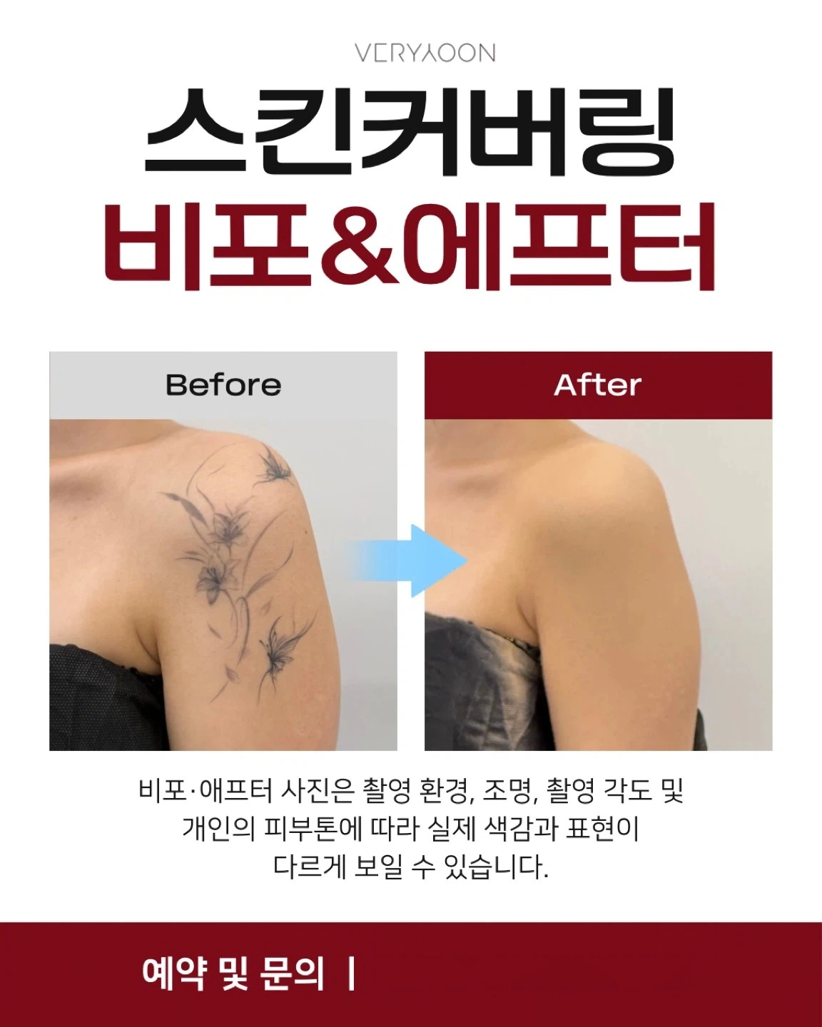 타투커버메이크업 모델구해요