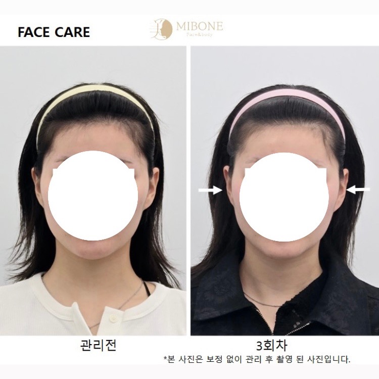 미본 페이스 신촌점 picture 5