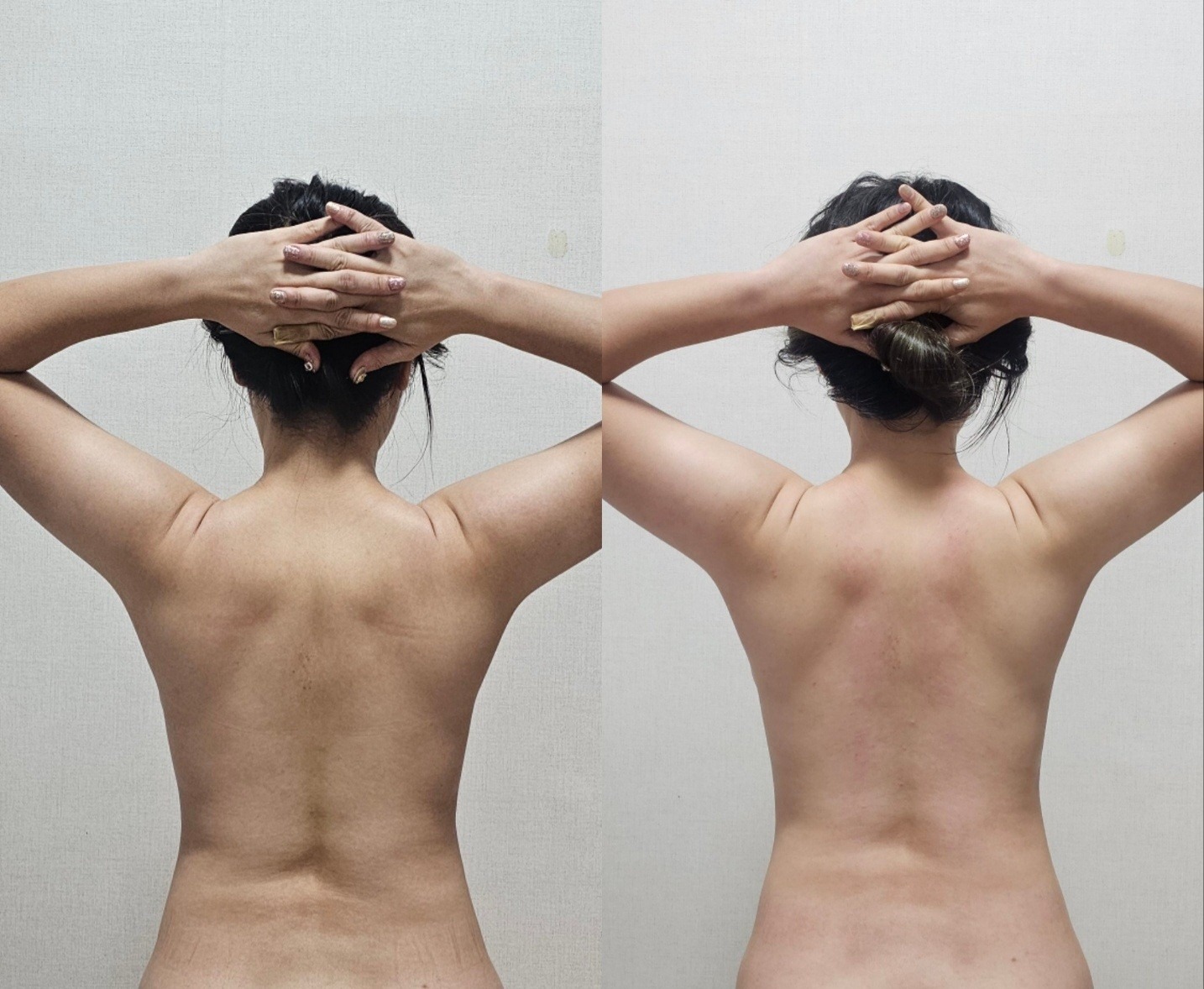 더슬림 림프순환 picture 1
