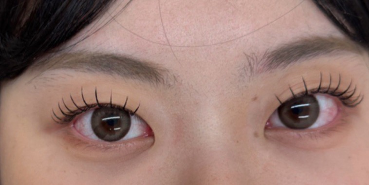뷰티해뉴 picture 3