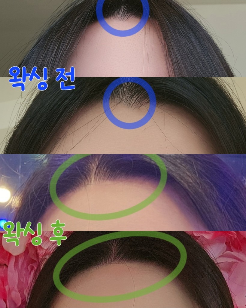 힐뷰티 picture 3