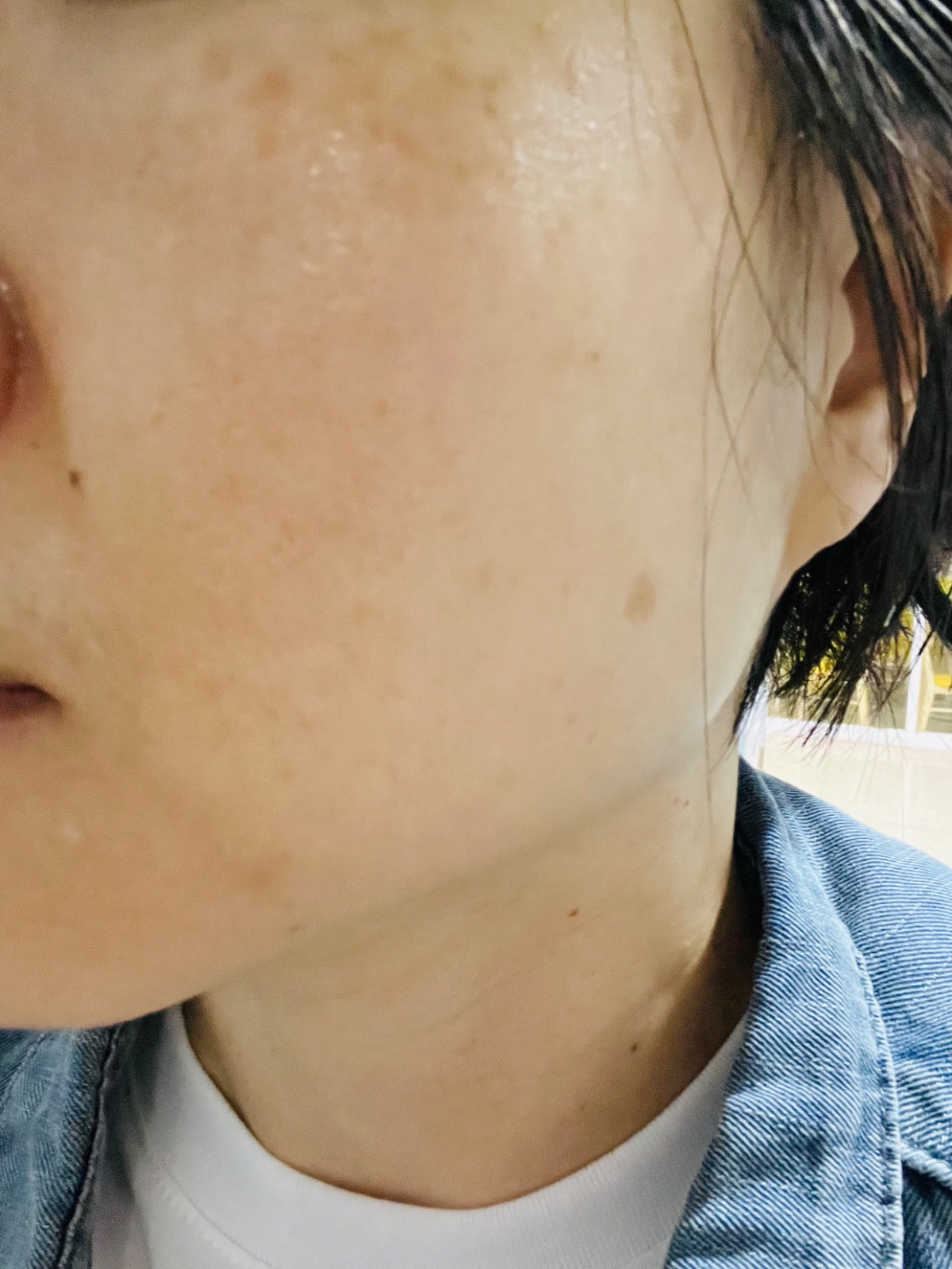 달에스테틱 picture 7