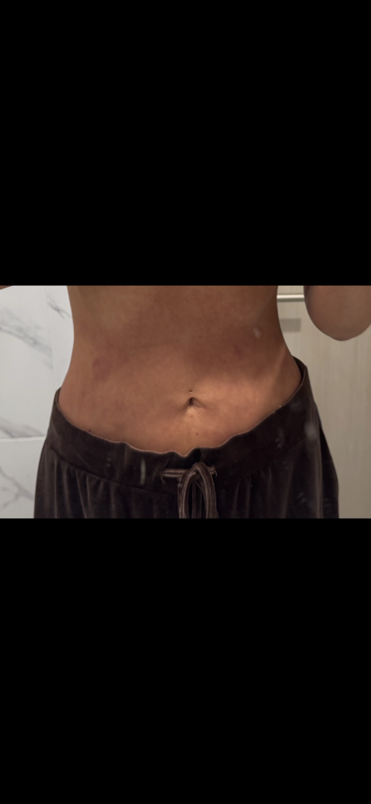 순환 관리 후기