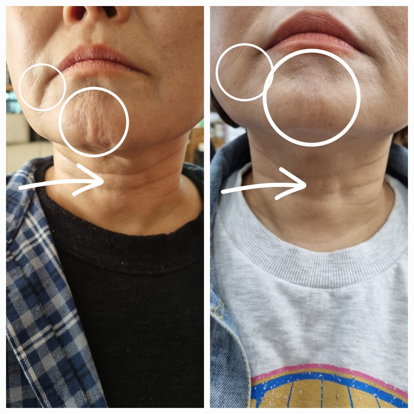 라하헤어 picture 4