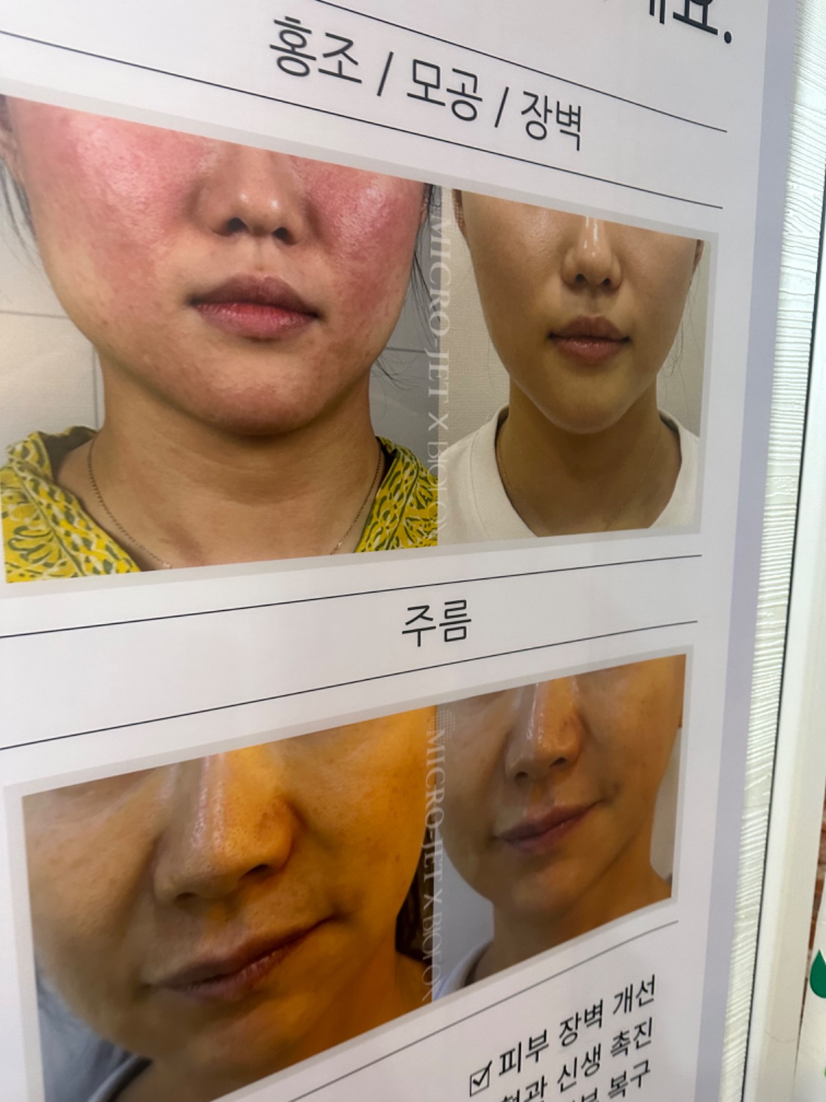 꽃다비스킨케어 picture 3