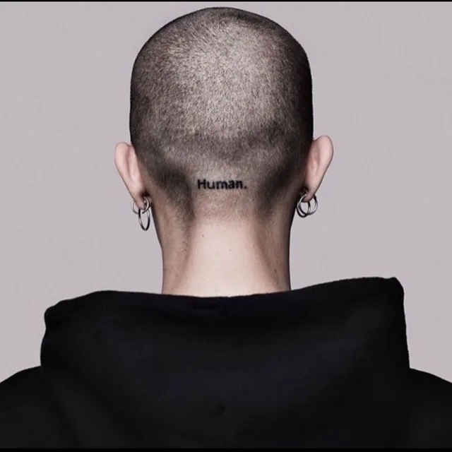 케이