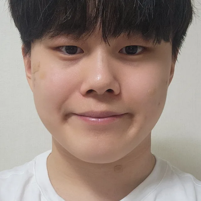 아그