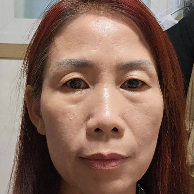 바람꽃