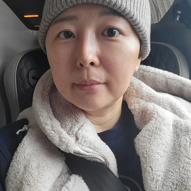 채희