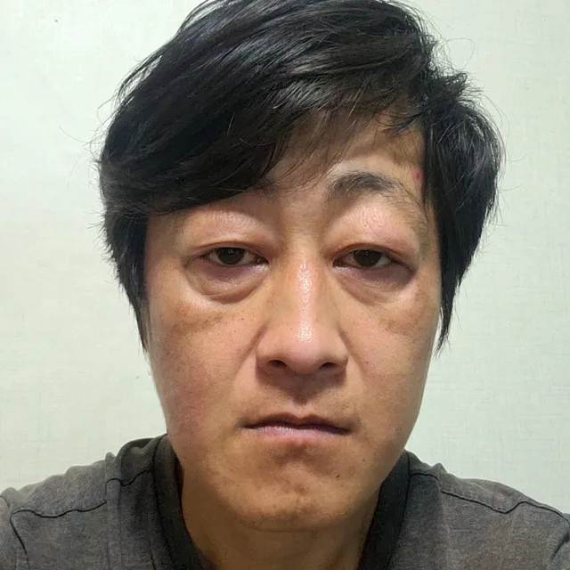 이덕희
