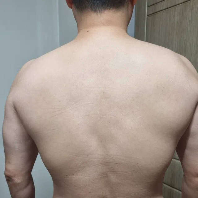 운동종
