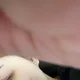 응응