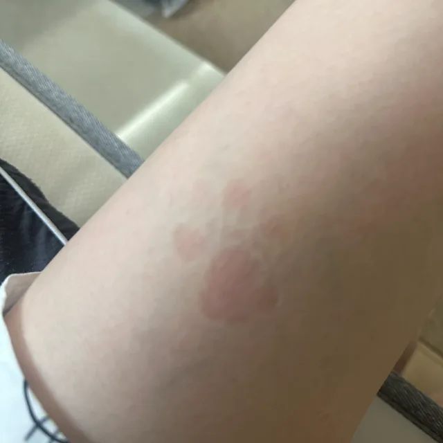배고파